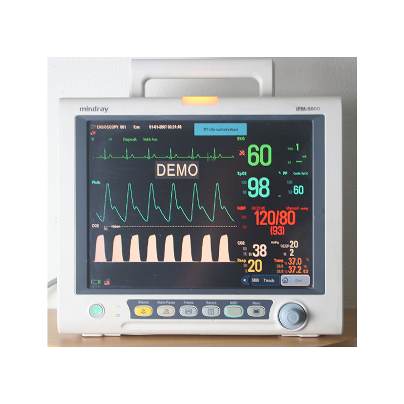 Patientenmonitor Mindray iPM9800 mit CO2-Messung und Recorder (gebraucht)